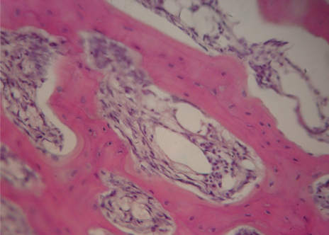 ГИПОЭСТРОГЕННАЯ МОДЕЛЬ ОСТЕОПОРОЗА ДВУСТОРОННЯЯ ОВАРИОЭКТОМИЯ 2,5 МЕСЯЦА